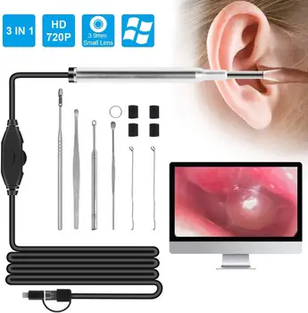 3.9 MM Smart Otoscope USB-Kõrva Endoscope Video Kaamera kutseeksami Earwax Eemaldamise Puhastus Komplekt Vahend Kõrvade Kontroll